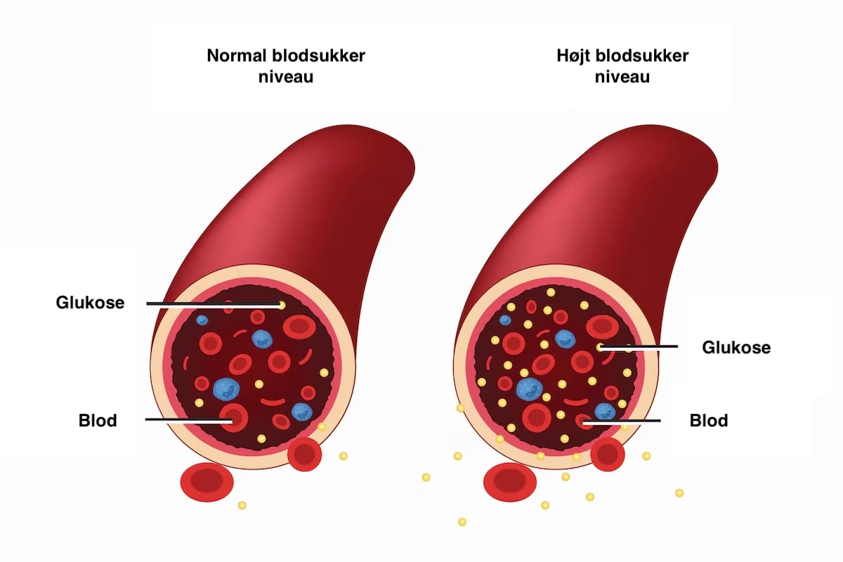 diabetes førstehjælp