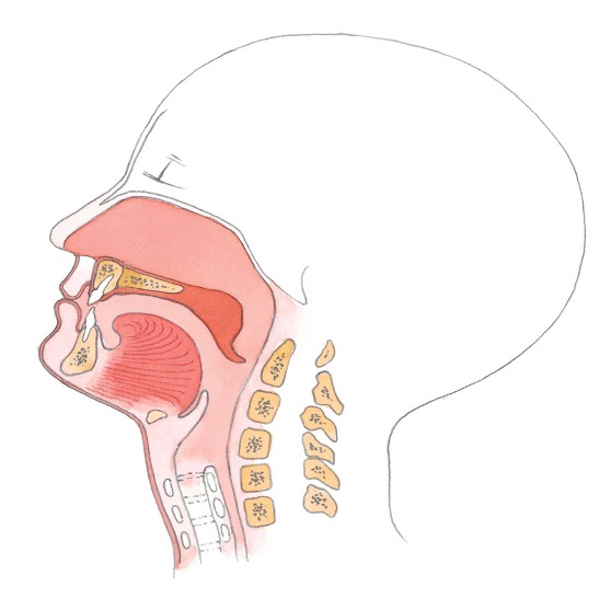 anatomi fremmedlegemer i luftvej