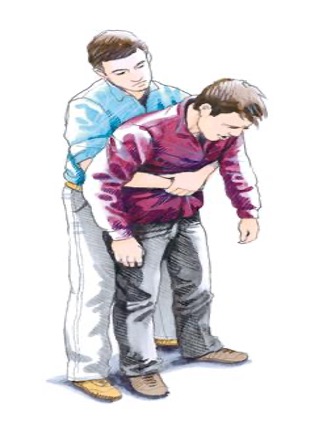 heimlich Heimlich manøvren sådan udfører du den