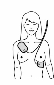 hjertestarter kvinde